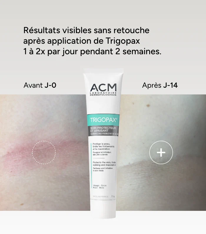 ACM Trigopax Soin Protecteur et Apaisant 30g Réparation Tissulaire Hydratation Durable Peaux Sensibles Irritées - Image 2