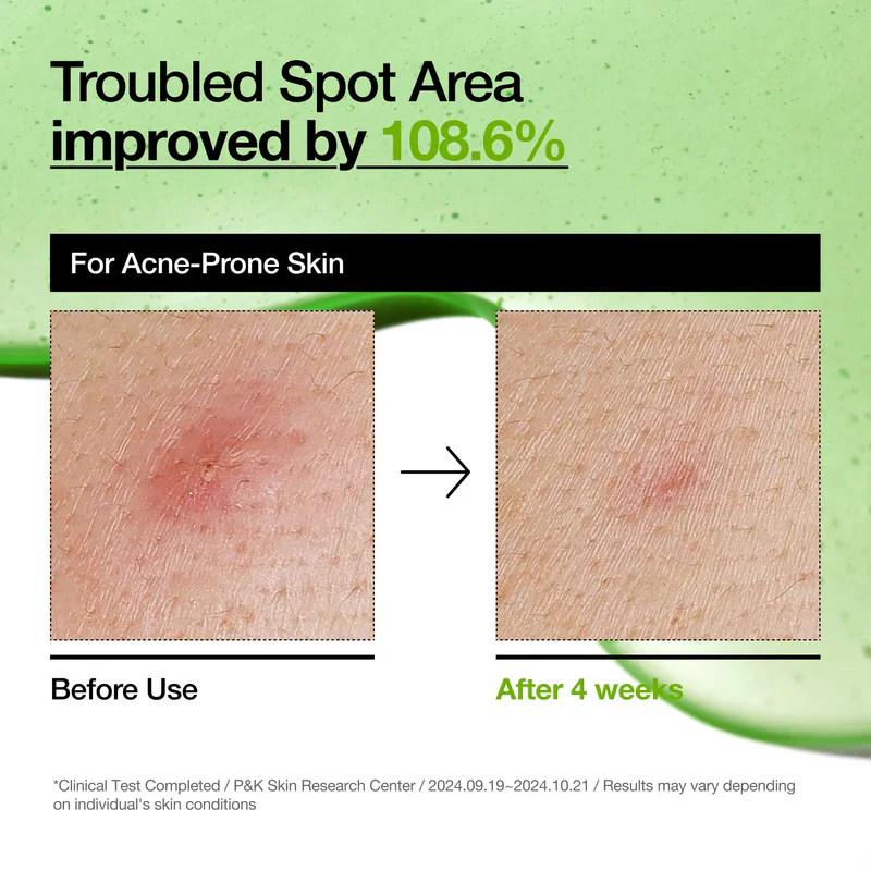 ANUA Azelaic Acid 10% Serum Hyaluronique 30ml Anti-Imperfections Éclat Taches Pigmentaires - Image 7