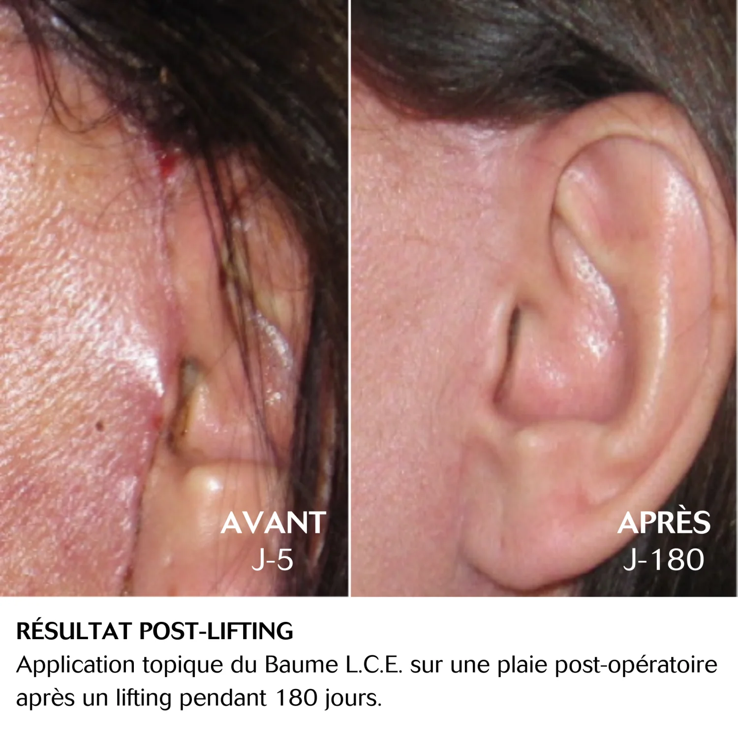 CEBELIA Baume L.C.E 15ml Soin Réparateur Peaux Irritées Sensibles Apaise Protège - Image 6