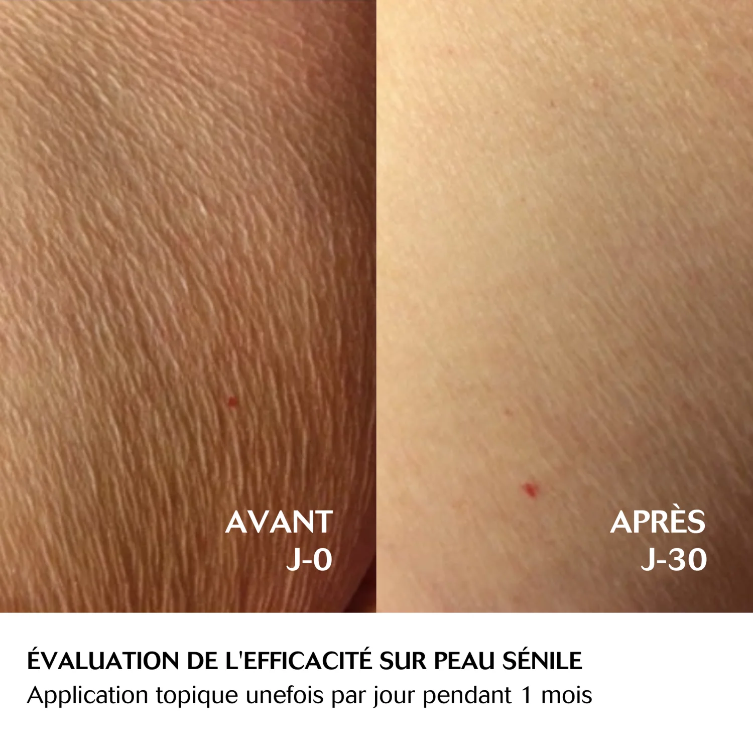 CEBELIA Lait Apaisant Corps Hydratant Anti-Démangeaisons 290ml Peaux Sèches Sensibles - Image 3