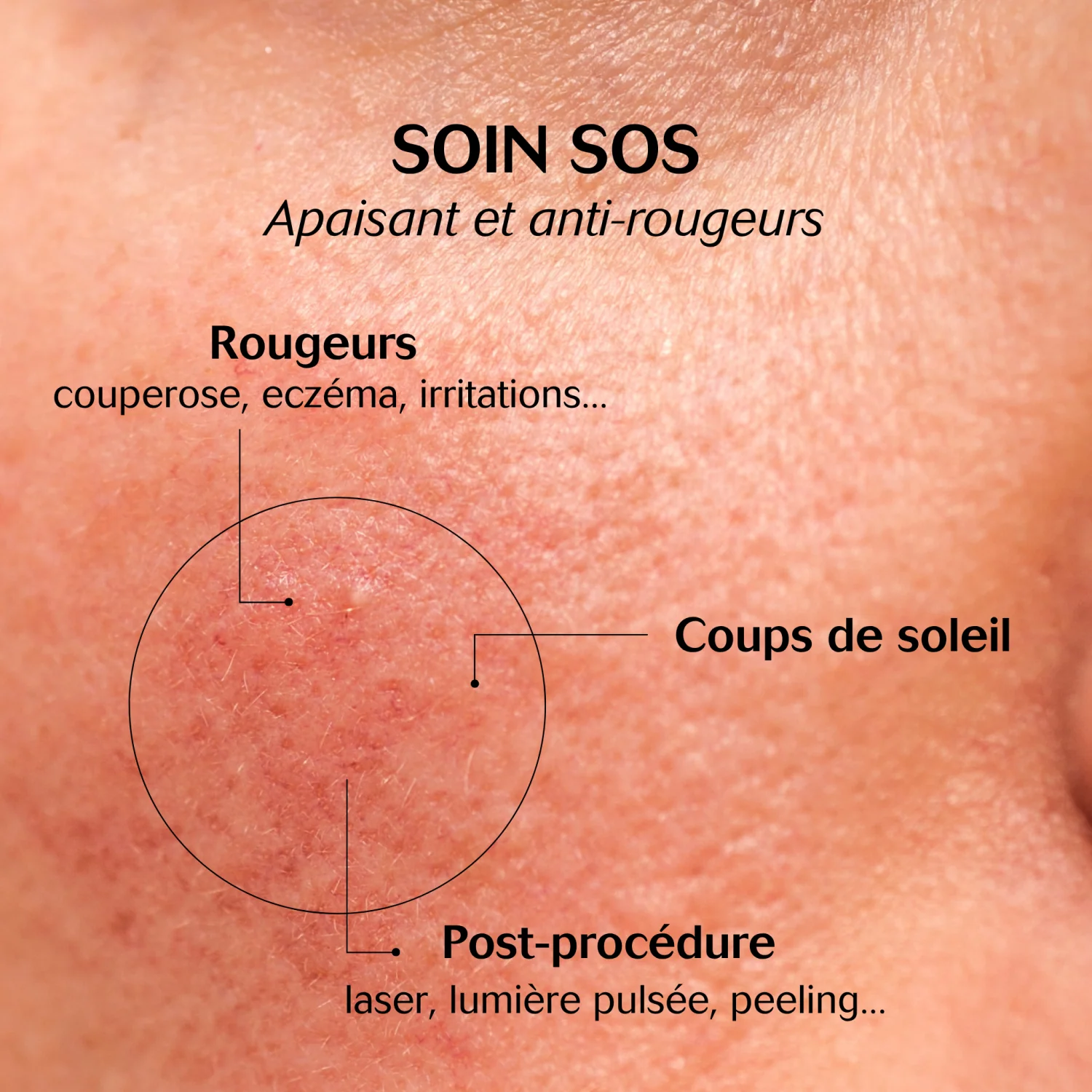 CEBELIA Soin Extrême Apaisant Anti-Rougeurs Visage Corps 75ml Peaux Sensibles Réactives - Image 4
