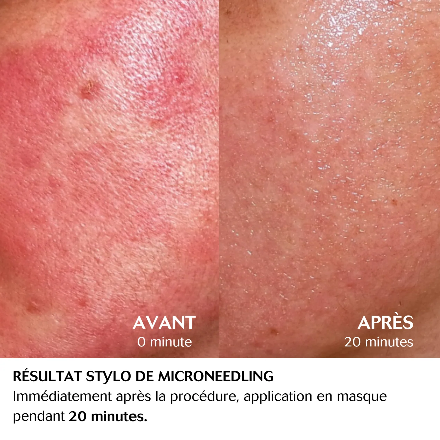 CEBELIA Soin Extrême Apaisant Anti-Rougeurs Visage Corps 75ml Peaux Sensibles Réactives - Image 7