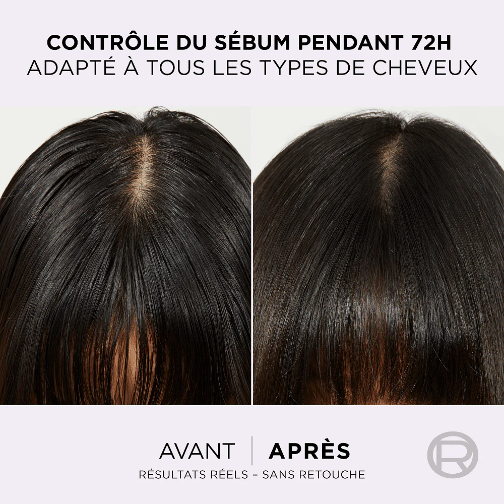 ELSEVE Hyaluron Pure Sérum Purifiant 102ml Acide Hyaluronique Cheveux Gras Racines Grasses Longueurs Sèches Sans Rinçage - Image 4