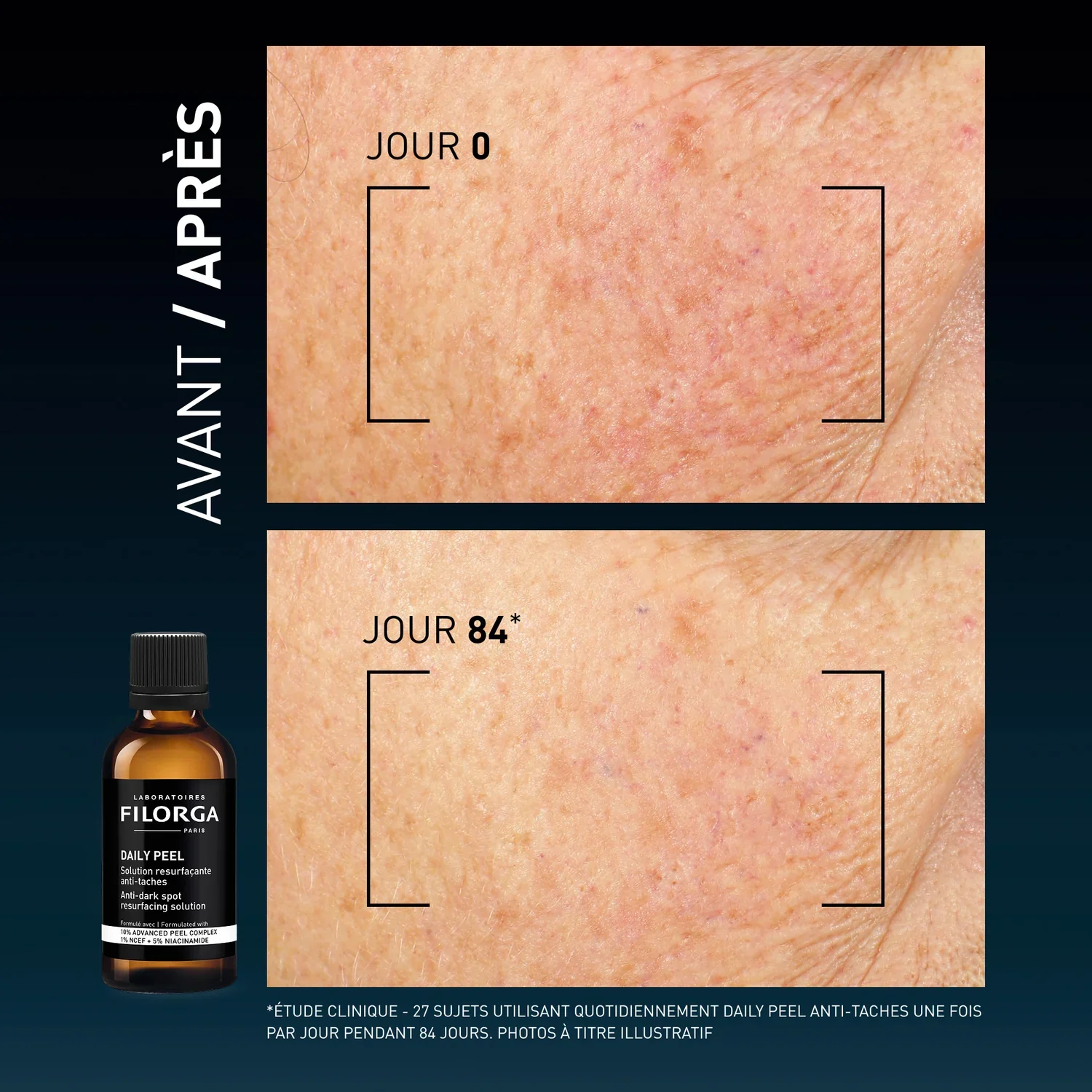 Filorga Daily Peel Anti Taches 50ml - Image 6