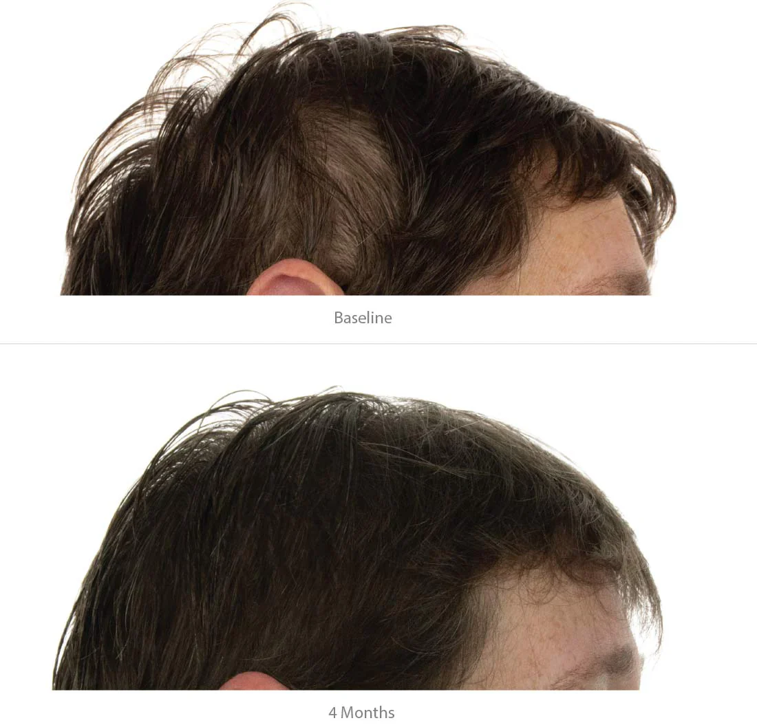FOLIGAIN Triple Action Conditioner Trioxidil 2% Femme Après-Shampoing Anti-Chute Cheveux Densité Volume Croissance Capillaire - Image 6