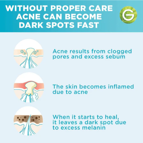 GARNIER SkinActive Fast Clear Booster Serum Acide Salicylique Sérum Anti-Acné Peau Grasse Imperfections Format Voyage - Image 2