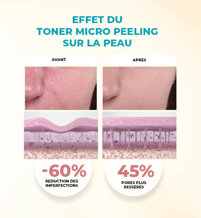 GLEAMY Toner Micro-Peeling 100ml Acide Salicylique Vitamine C Niacinamide Éclat - Image 3