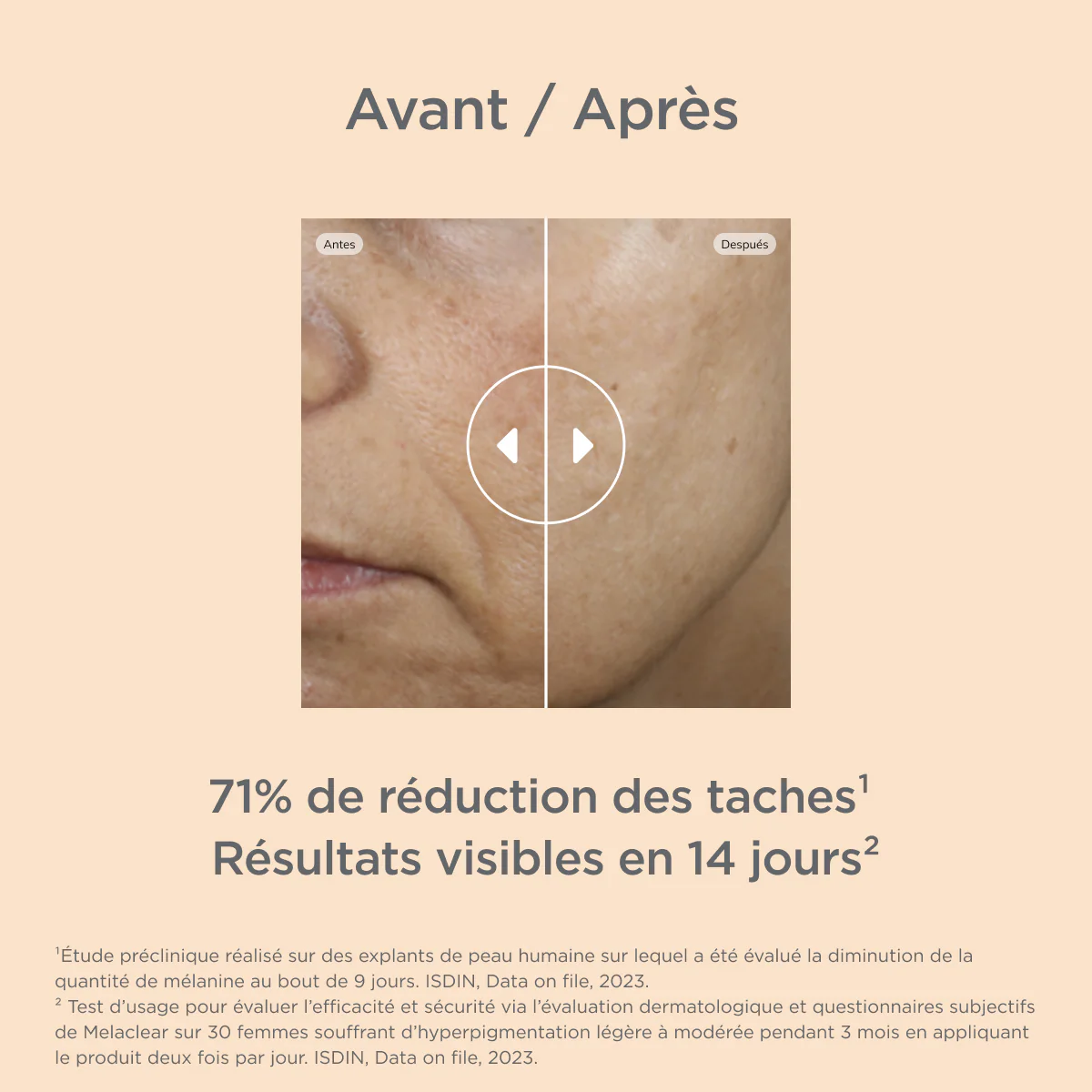 ISDIN Melaclear Sérum Anti-Taches 30ml Correcteur Éclat Pigmentation Visage - Image 2