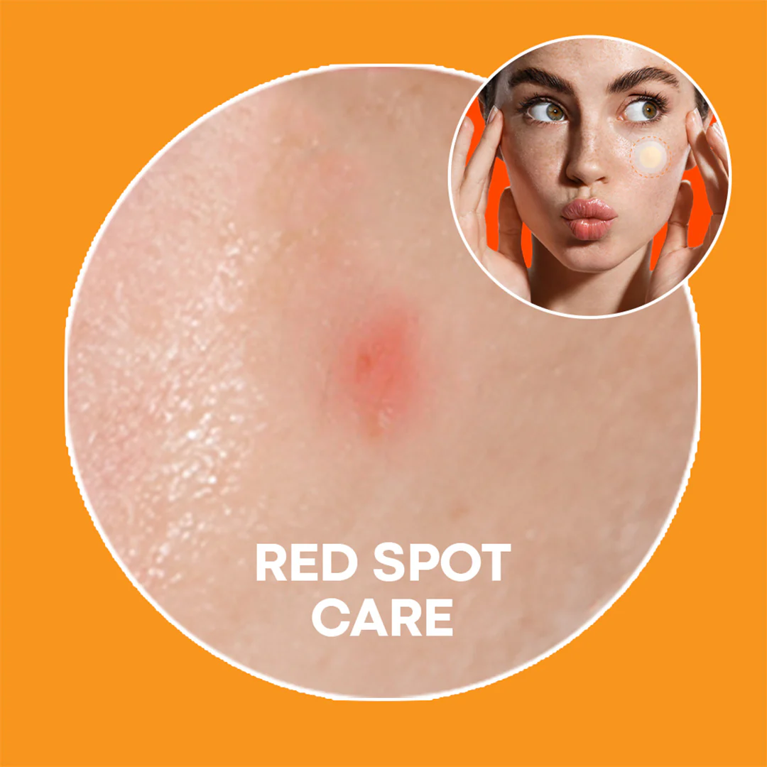 NOLAHOUR Spot Eraser Orange Step03 12 Patchs Anti-Taches Cicatrices Acné Éclaircissant - Image 3