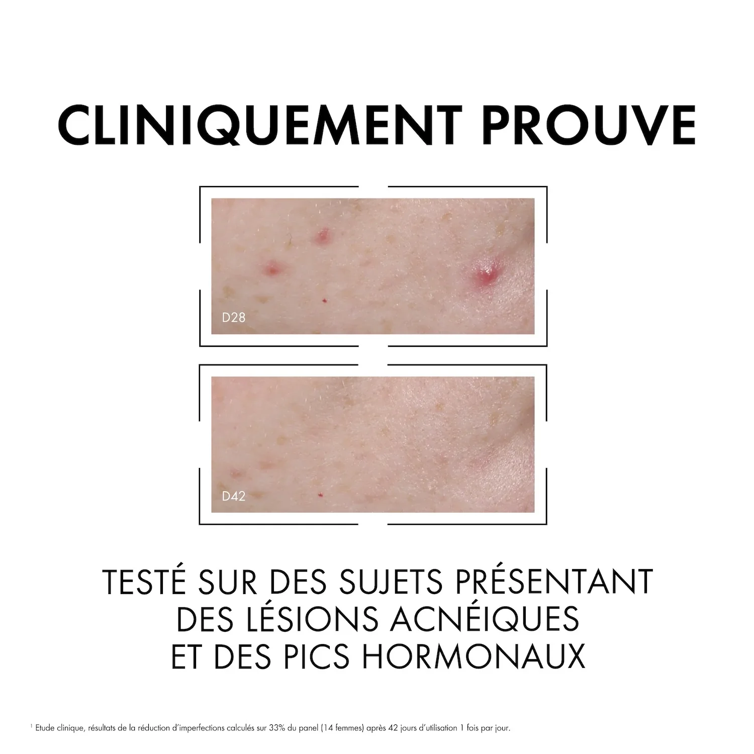 VICHY Normaderm Sérum Anti-Imperfections Probio-BHA Purifiant 30ml - Image 5