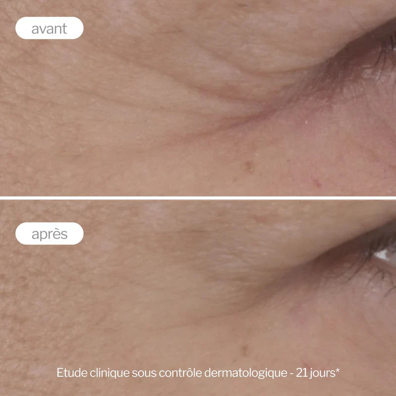 NOVEXPERT Contour Des Yeux Anti-Age Expert 15ml - Soin Contour Yeux Anti-Rides Premium - Image 7