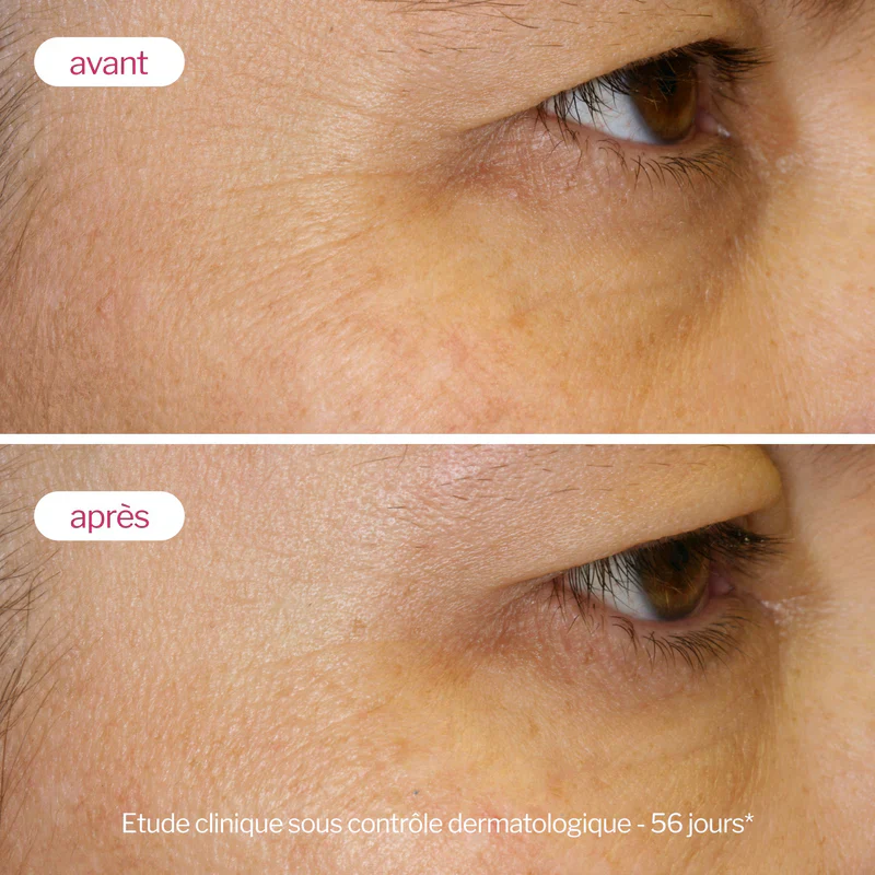 Novexpert La Crème Repulp Acide Hyaluronique 40ml Anti-Âge Hydratant Repulpant - Image 3