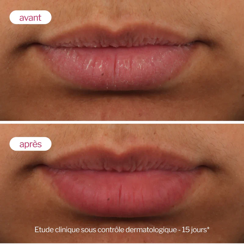 Novexpert Lip'Up Baume Lèvres Repulpant Acide Hyaluronique 8ml Volumateur - Image 5