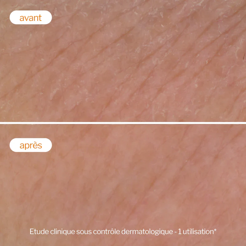 Novexpert Mousse Nettoyante Flash Éclat Vitamine C 150ml Démaquillant Exfoliant x 2 Duo Pack - Image 9