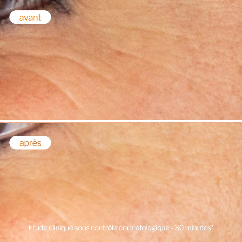 NOVEXPERT Booster Vitamine C 30ml Ultra Concentré 25% Éclat Anti-Âge - Image 6