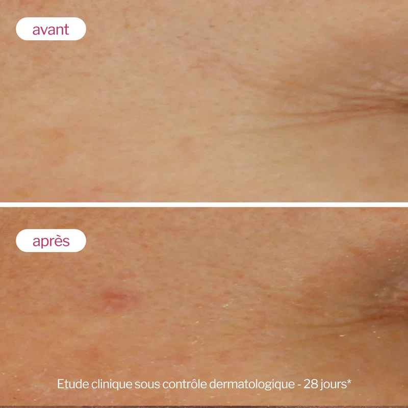 Novexpert Sérum Booster Acide Hyaluronique 30ml Hydratant Anti-Âge Concentré - Image 7