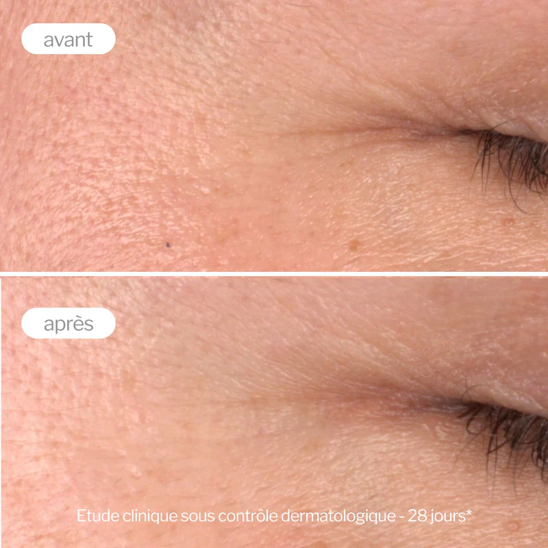 NOVEXPERT Sérum Booster Pro-Collagène 30ml - Sérum Anti-Âge Repulpant Premium - Image 3