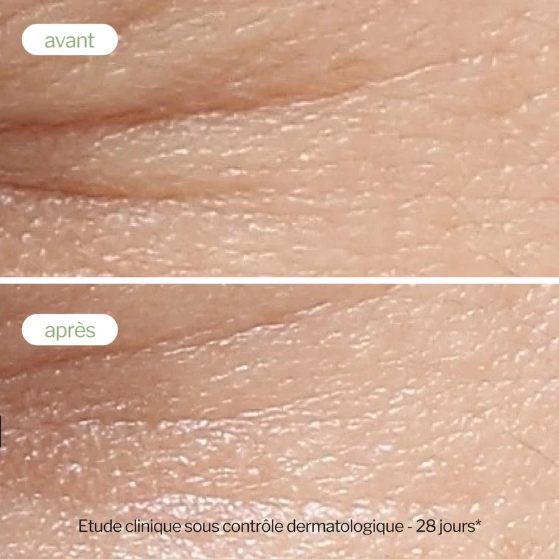 NOVEXPERT Sérum Booster Whitening 30ml - Sérum Éclaircissant Anti-Taches Premium - Image 7