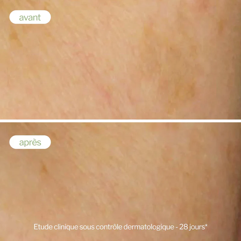 NOVEXPERT Soin Ciblé Correcteur De Taches 2ml - Stylo Anti-Taches Précision Premium - Image 7