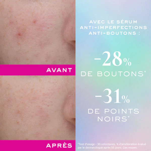 NUXE Zinc Power Sérum Anti-Imperfections 30ml Soin Visage Anti-Boutons Peaux Grasses - Image 3