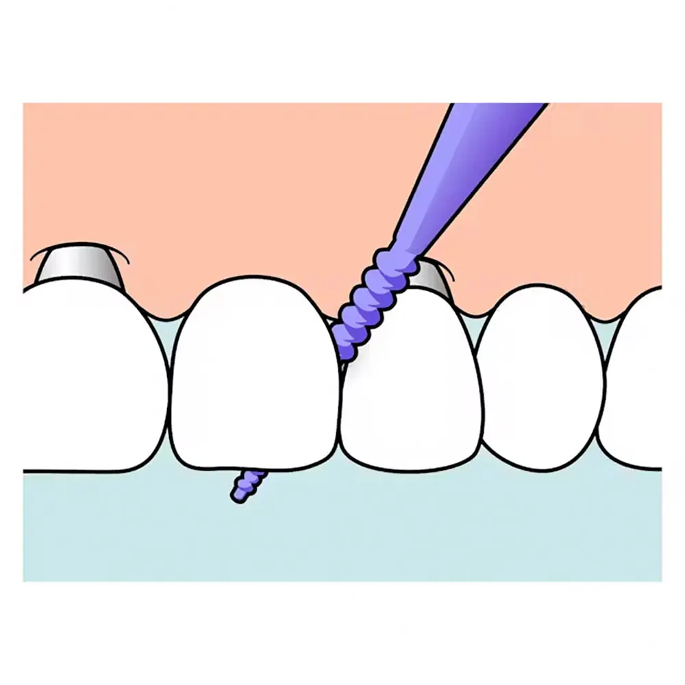 TePe EasyPick 36 Pièces Taille XL Violet Bâtonnets Interdentaires Silicone - Image 3