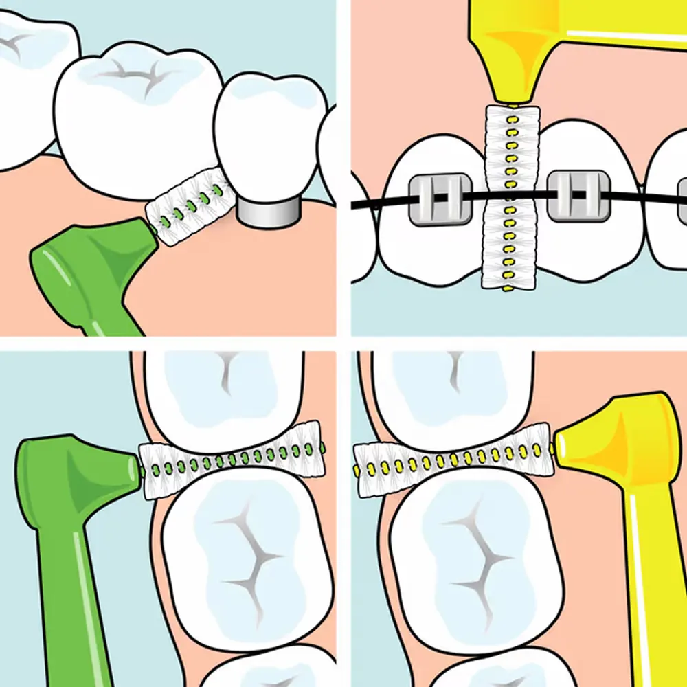 TEPE Brossettes Interdentaires Angle 0.45mm Taille 1 Orange 6 Pièces Hygiène Bucco-Dentaire - Image 3