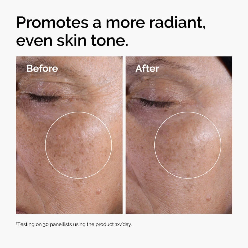 THE ORDINARY Glycolic Acid 7% Exfoliating Toner 100ml Lotion Tonique Exfoliante - Image 5
