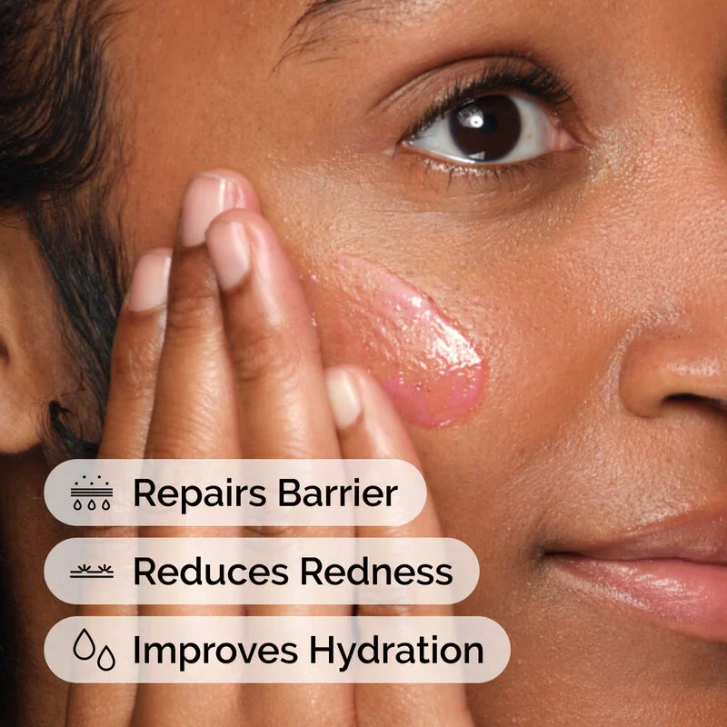 The Ordinary Soothing and Barrier Support Serum 30ml - Image 4
