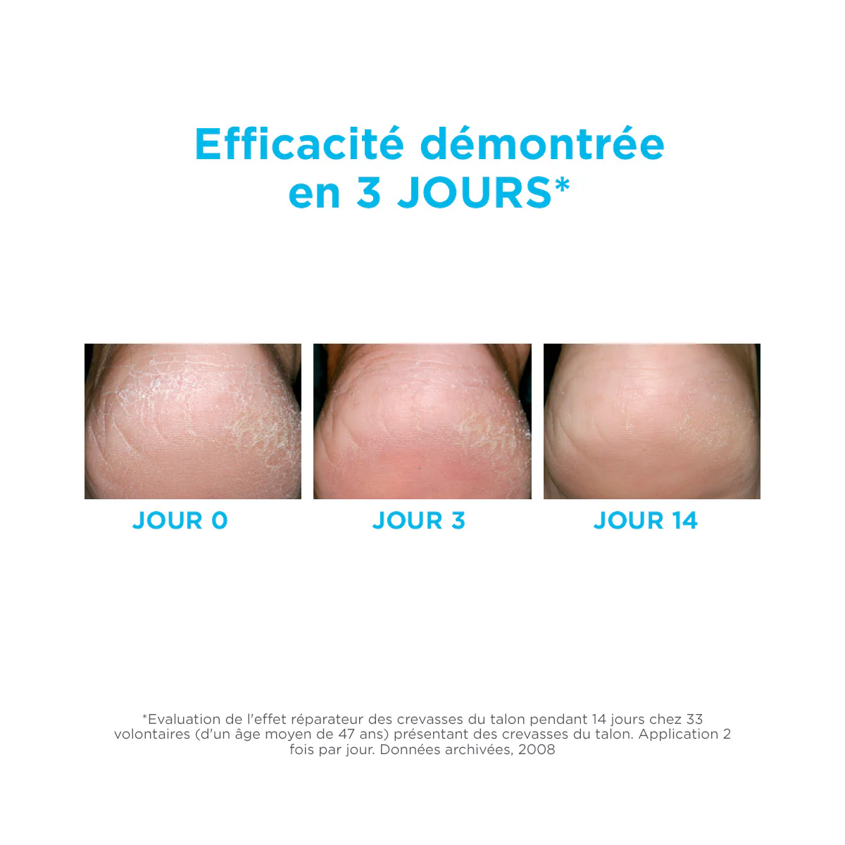 ISDIN Ureadin Crème Pieds 75ml Hydratante Peau Élastique Pénétration Rapide - Image 7