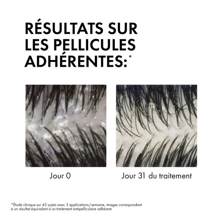 VICHY Dercos Eco-Recharge Shampoing Anti-Pelliculaire Cheveux Secs Éco-Responsable 390 ml - Image 3
