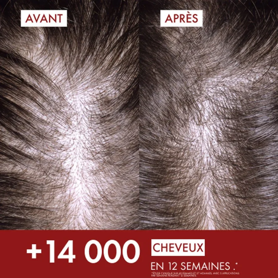 VICHY DERCOS Sérum REGENBOOSTER Rénovateur 100ml Densité Capillaire Anti-Chute Repousse Cheveux Stemoxydine Resveratrol - Image 2