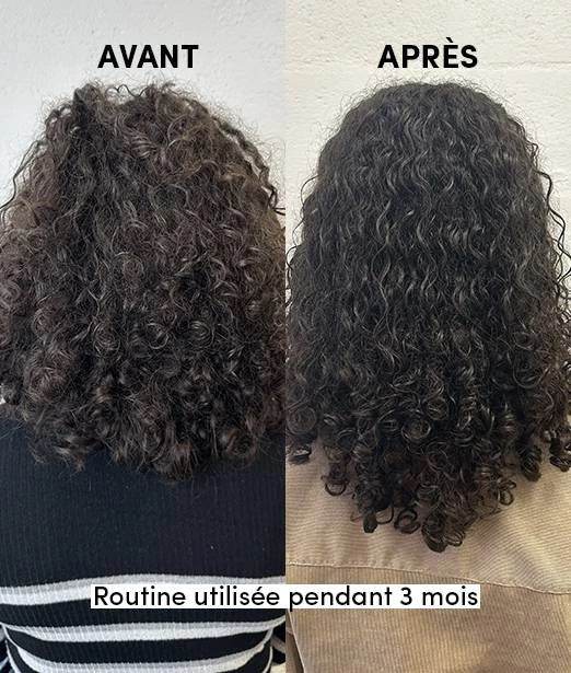 WAAM PACK d'Huiles Spéciales Pousse Cheveux Trio Stimulant Croissance Capillaire Ricin Nigelle Coco Bio Fortifiant Naturel - Image 3